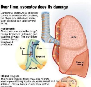 Asbestos damage to the lungs