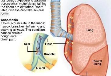 What to know about Asbestos in the Home